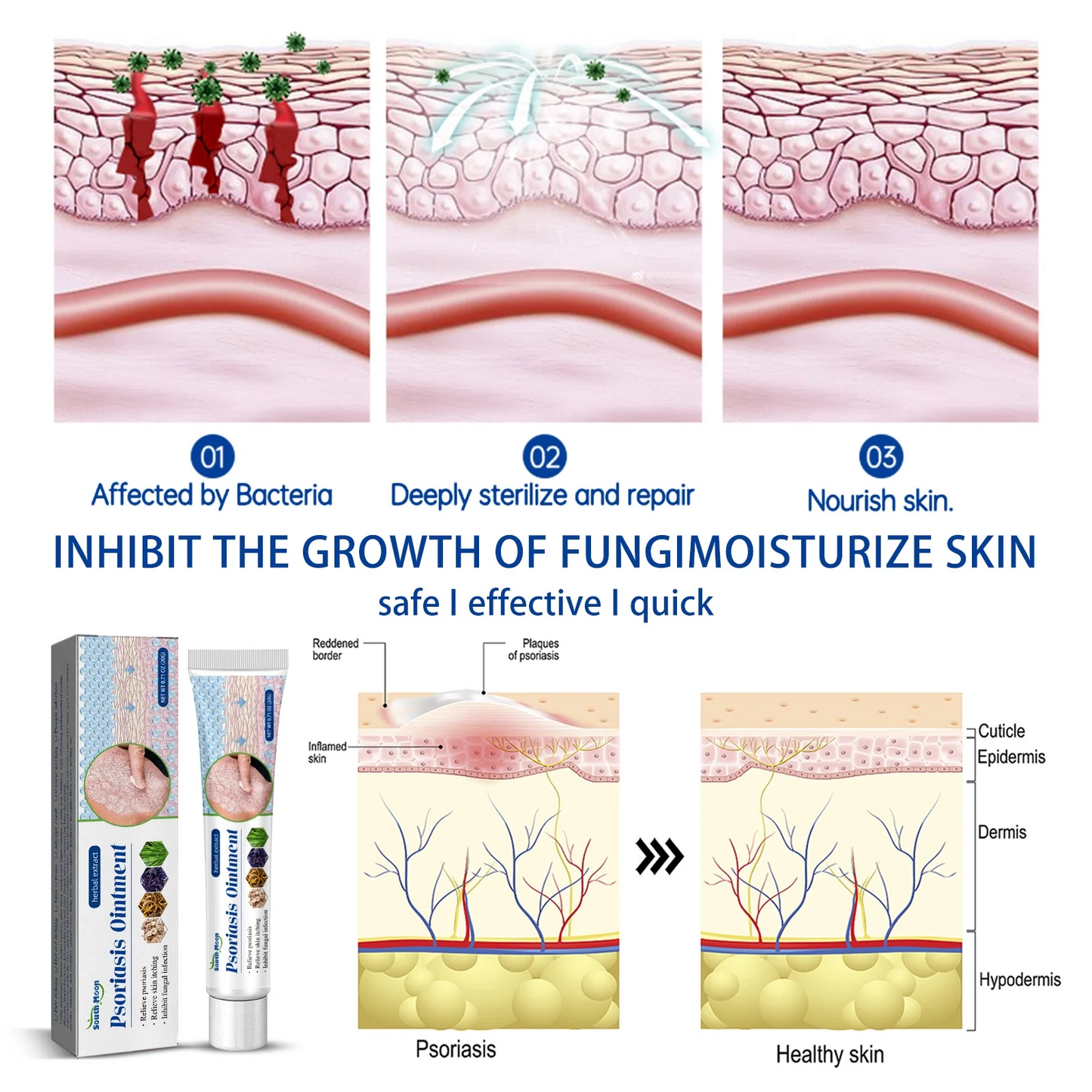 Pommade pour le Psoriasis