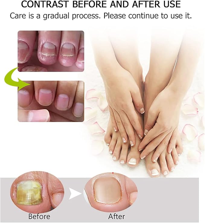 Gel Réparateur pour Traitement des Ongles