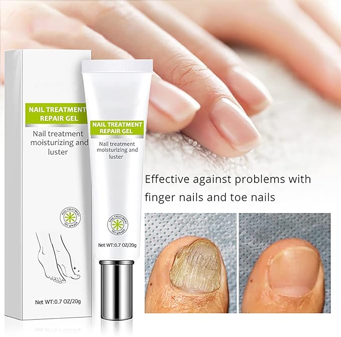 Gel Réparateur pour Traitement des Ongles