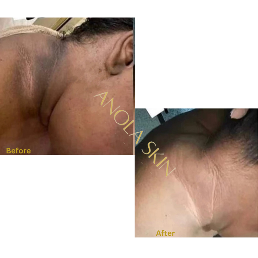 Soin Intensif Anti-Taches & Décoloration