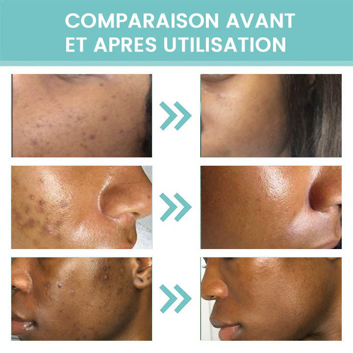 Eelhoe Crème Correctrice de Taches