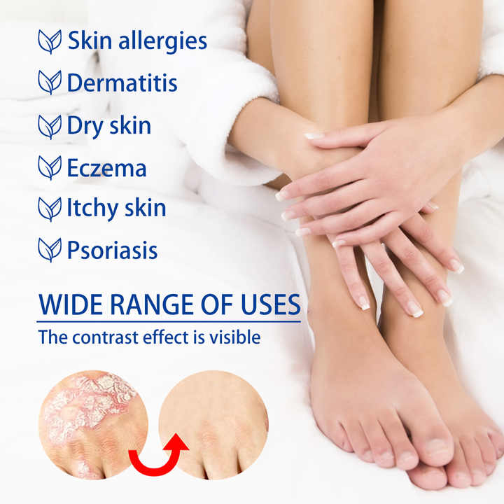 Pommade pour le Psoriasis