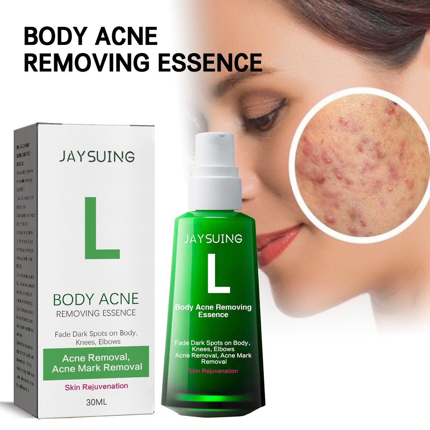 Sérum Anti-Acne