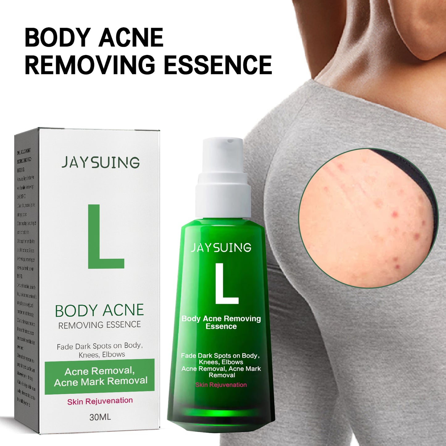 Sérum Anti-Acne