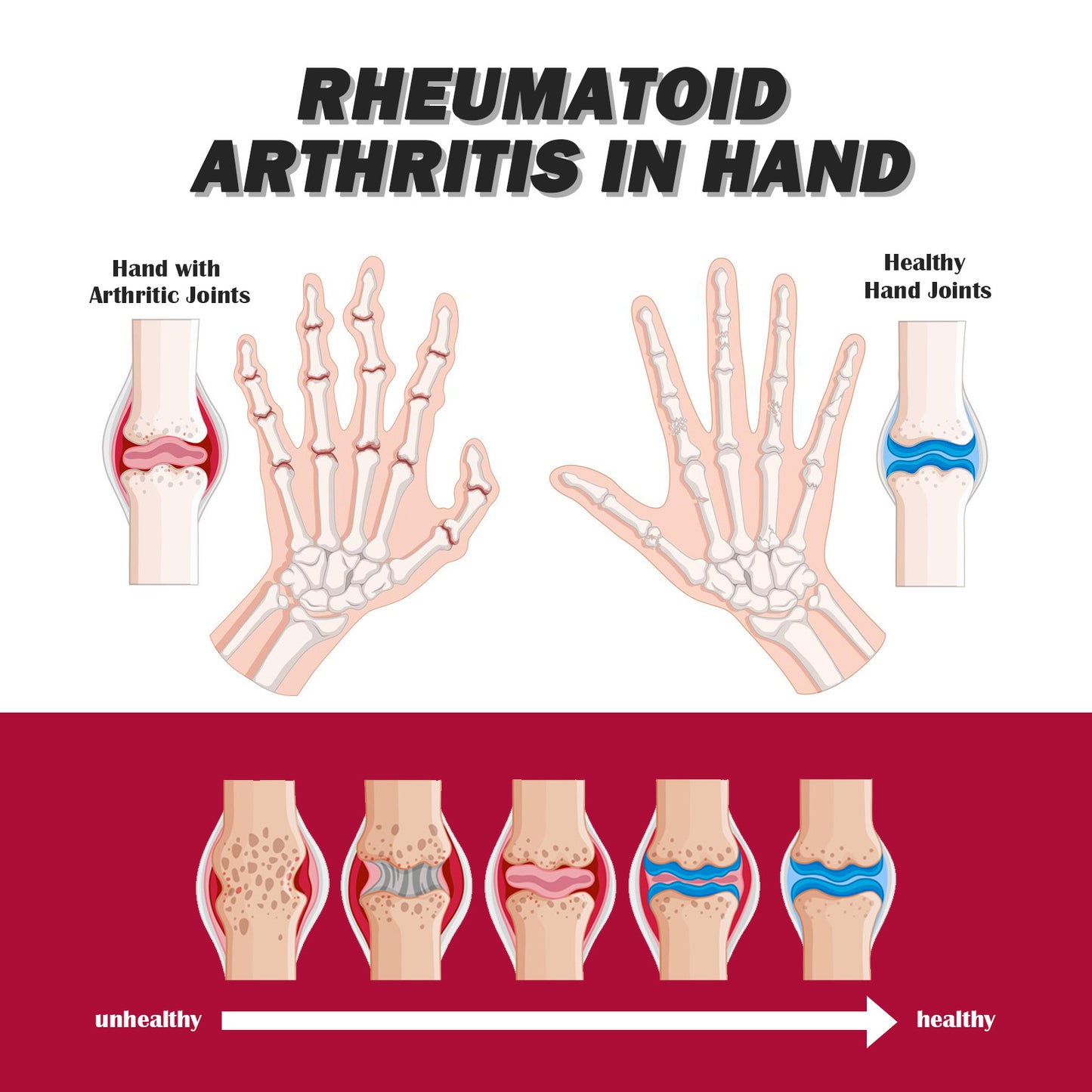 Crème Thérapeutique pour Articulations et Muscles