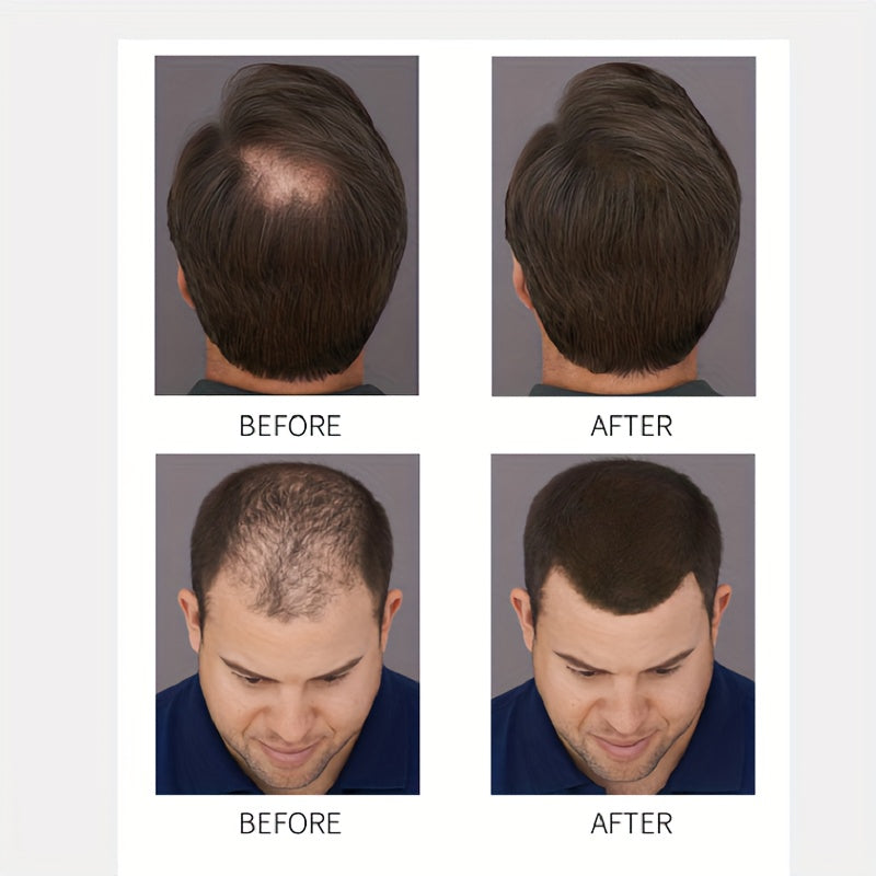 FullHair Pro - Fibres capillaires des cheveux