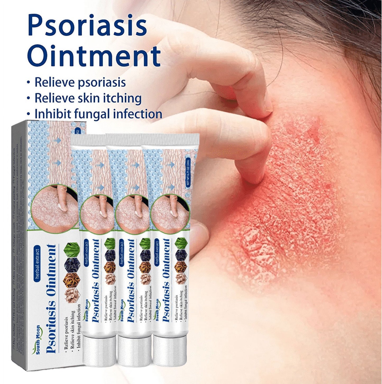 Pommade pour le Psoriasis