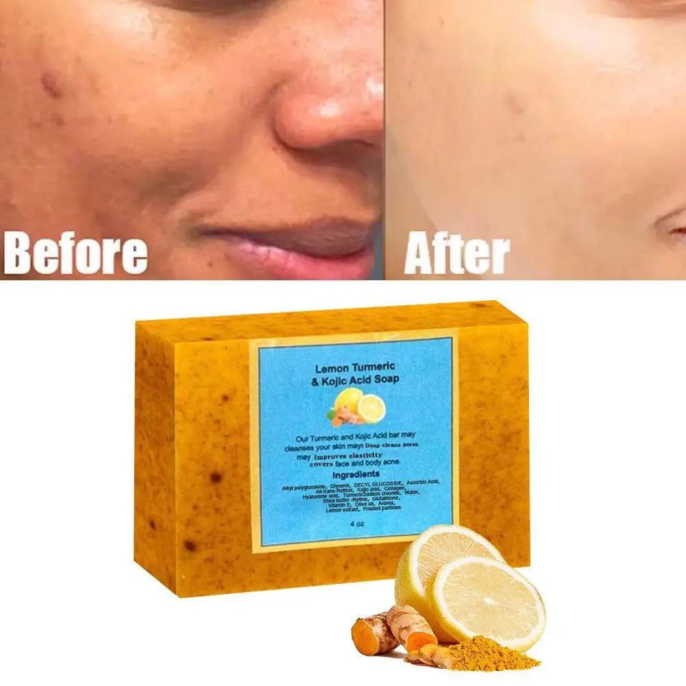 Savon pour peau éclatante
