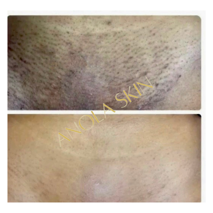 Soin Intensif Anti-Taches & Décoloration