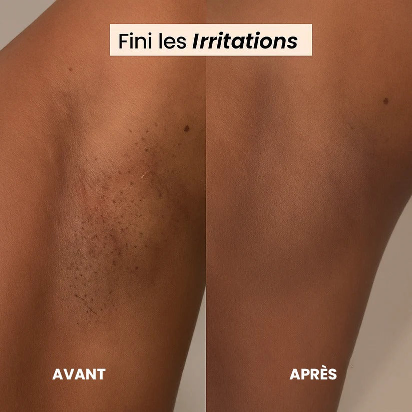 Rasoir Électrique Femme 2-en-1 – Waterproof & Rechargeable | Doux & Sans Douleur