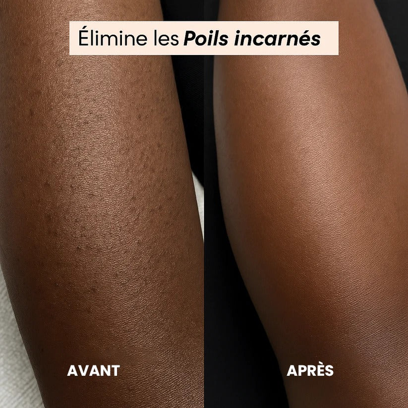Rasoir Électrique Femme 2-en-1 – Waterproof & Rechargeable | Doux & Sans Douleur