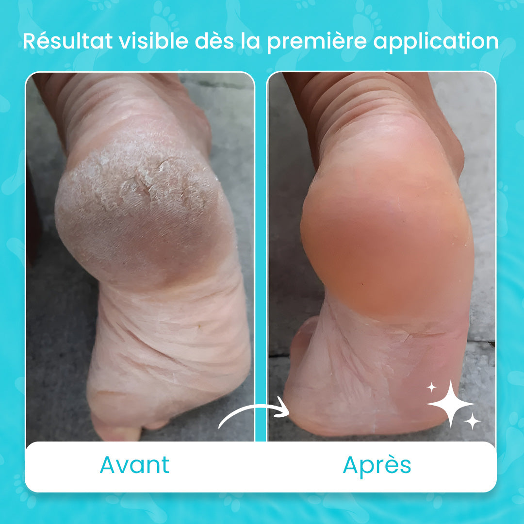 Pack pieds zurie
