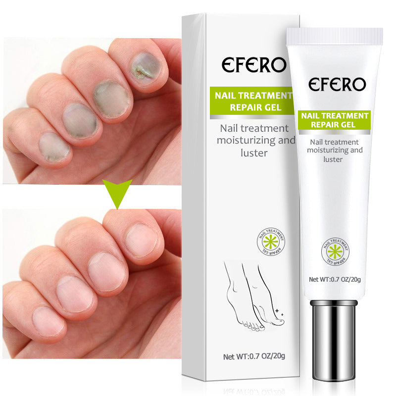 Promoteur de Croissance des Ongle