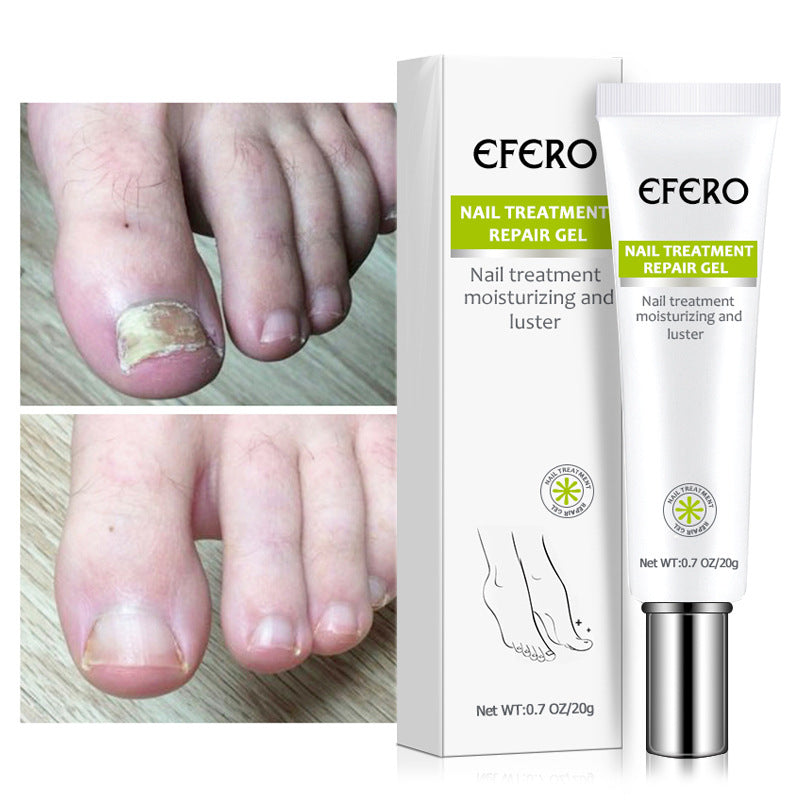 Promoteur de Croissance des Ongle