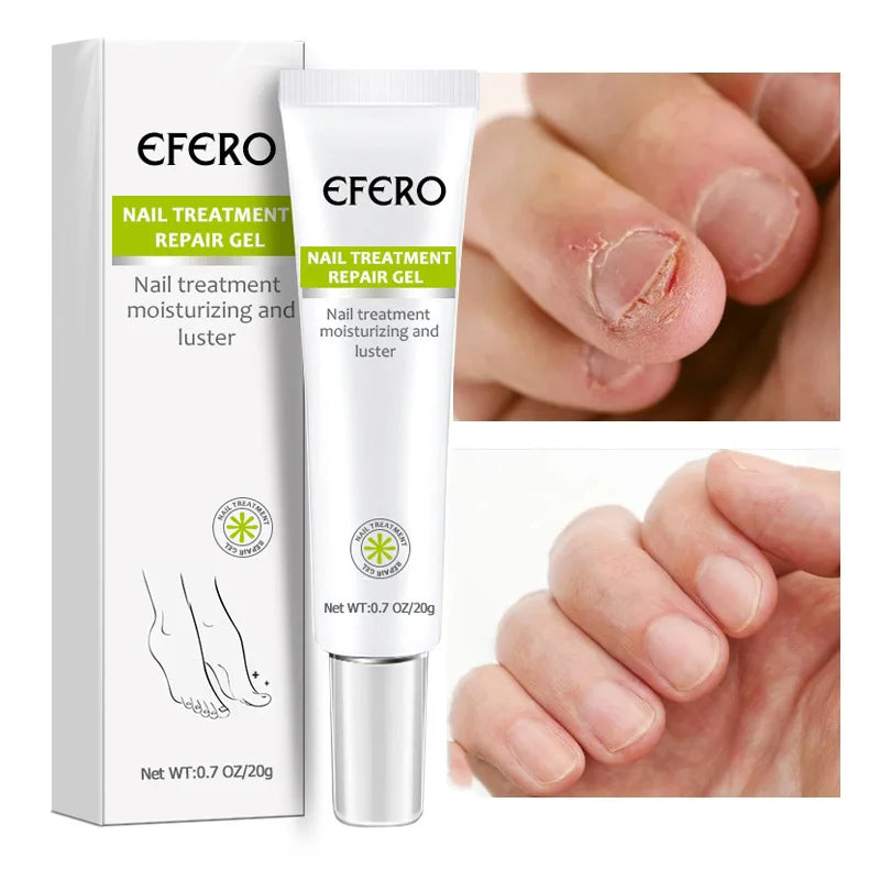 Promoteur de Croissance des Ongle