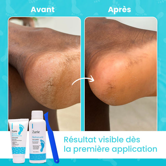 Pack pieds zurie