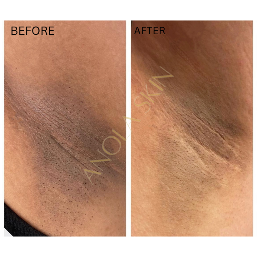 Soin Intensif Anti-Taches & Décoloration