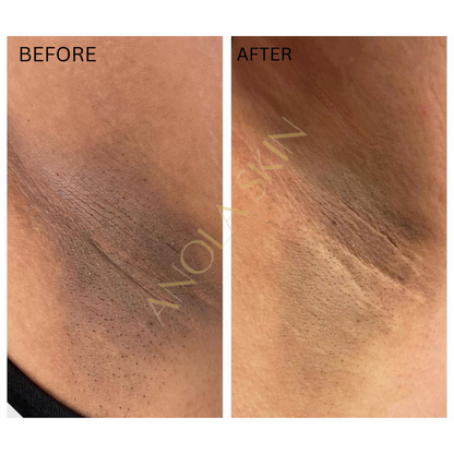 Soin Intensif Anti-Taches & Décoloration