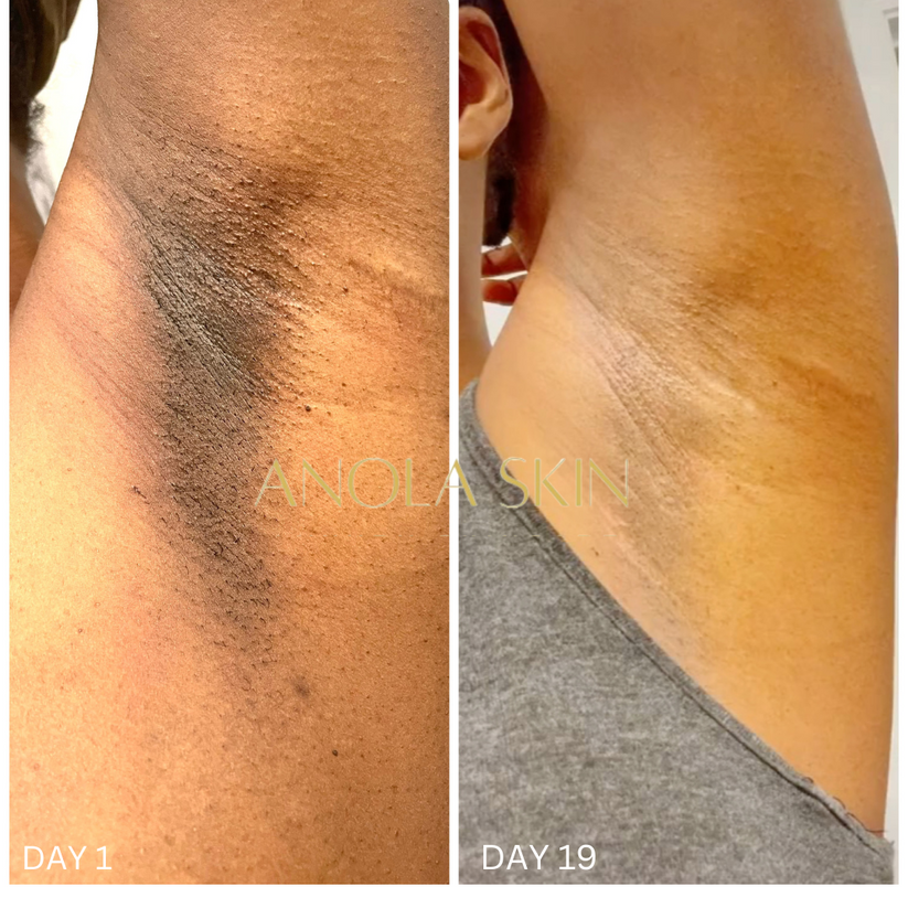 Soin Intensif Anti-Taches & Décoloration