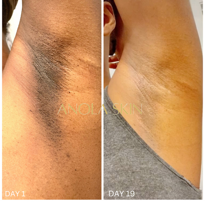 Soin Intensif Anti-Taches & Décoloration