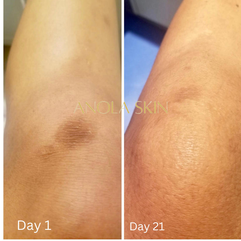 Soin Intensif Anti-Taches & Décoloration