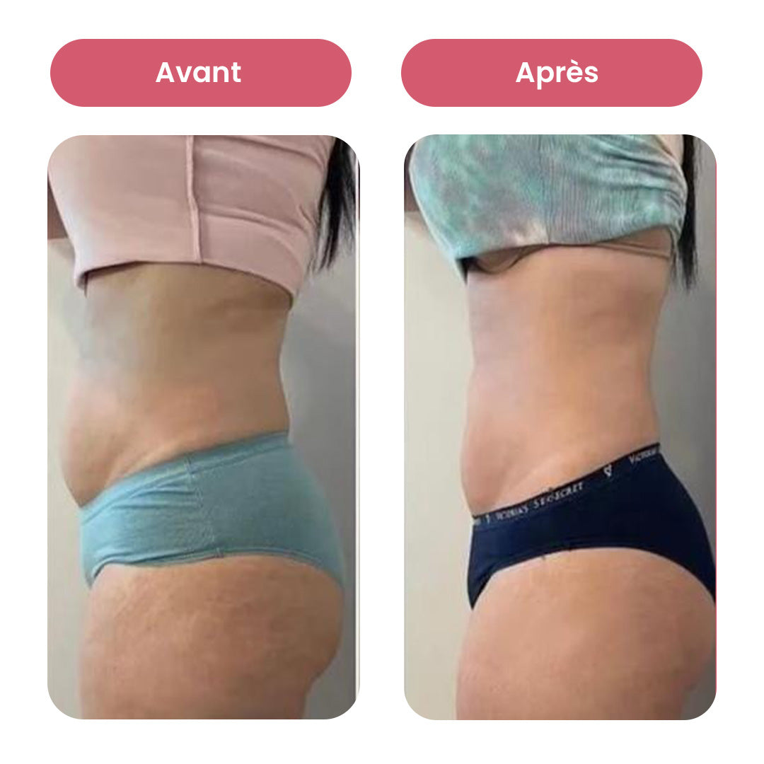 Masseur Anti-Cellulite Électrique