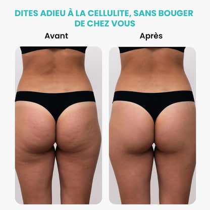 Masseur Brûleur de Graisses Électrique Rotatif – Anti-Cellulite & Minceur