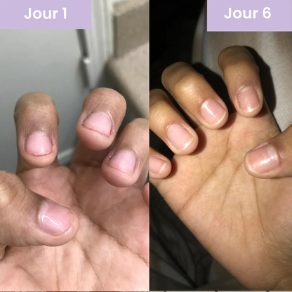 Gel Renaissance Ongles au Keratin