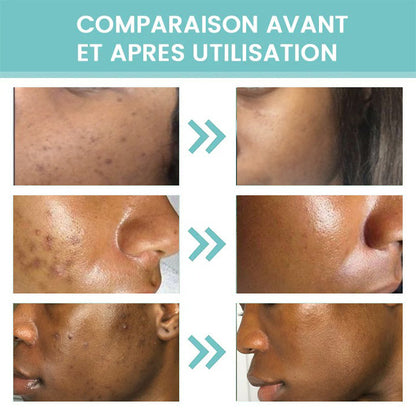 Eelhoe Crème Correctrice de Taches