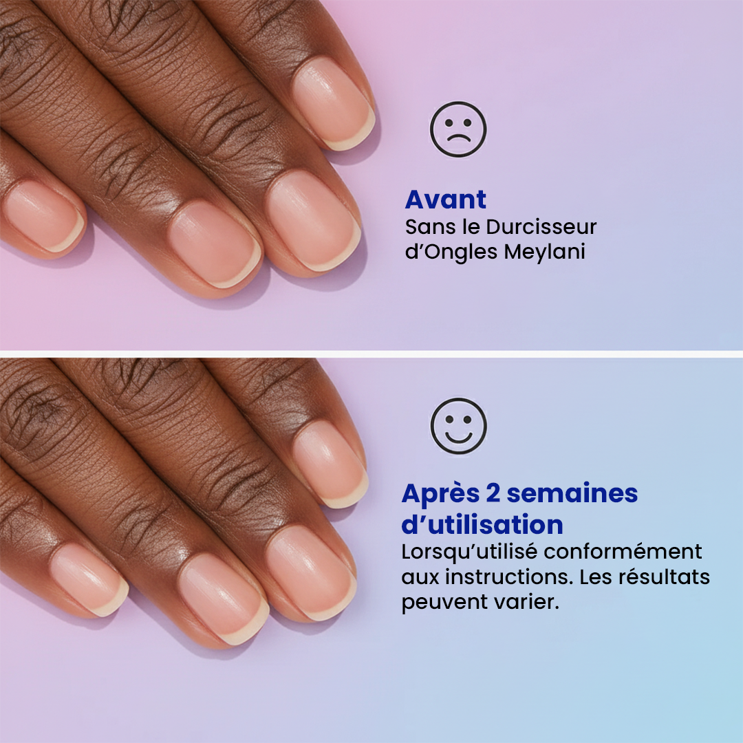 Gel Renaissance Ongles au Keratin