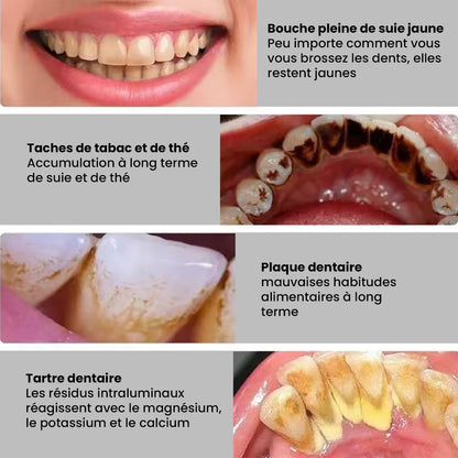 Electric Teeth Cleaner