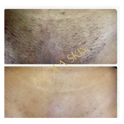 Soin Intensif Anti-Taches & Décoloration