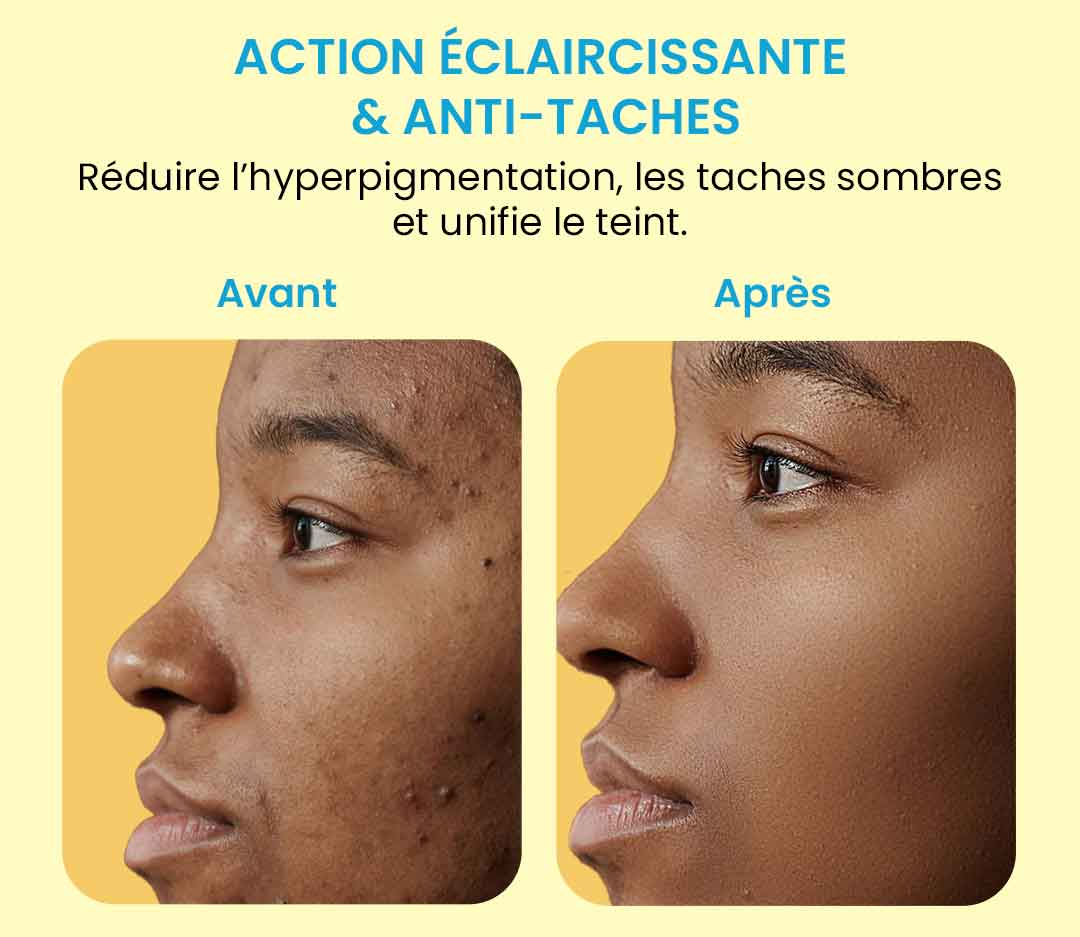 Nettoyants au Curcuma et à l'Acide Kojique