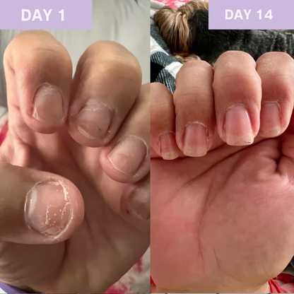 Gel Renaissance Ongles au Keratin