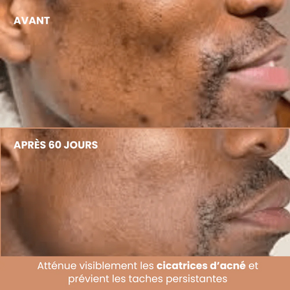 Pads Curcuma Anti-Taches – Peaux Noires & Métissées