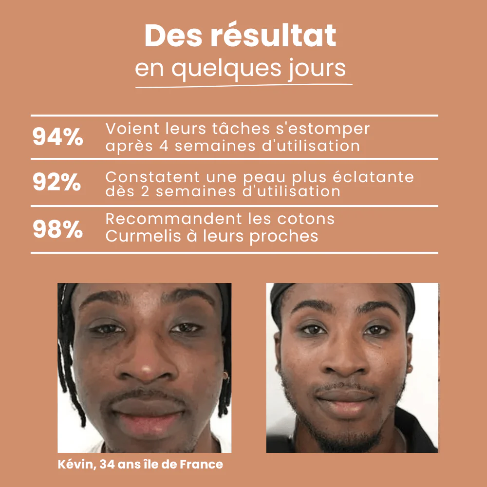 Pads Curcuma Anti-Taches – Peaux Noires & Métissées