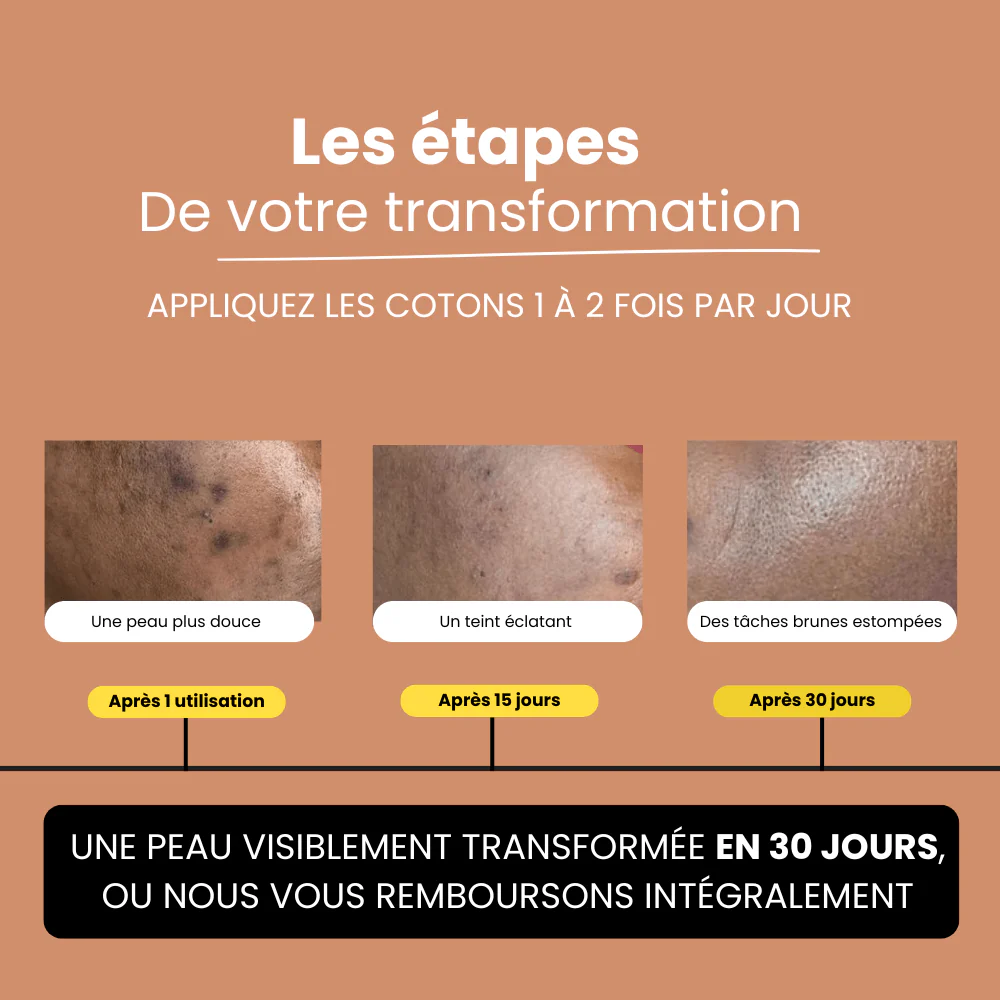 Pads Curcuma Anti-Taches – Peaux Noires & Métissées
