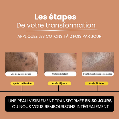 Pads Curcuma Anti-Taches – Peaux Noires & Métissées
