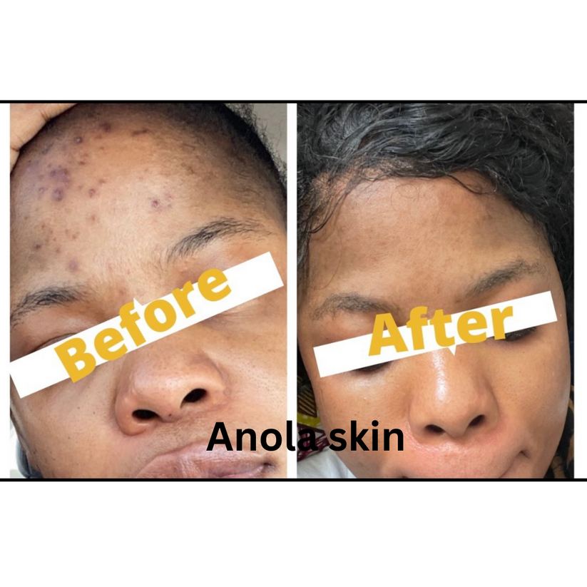 Soin Intensif Anti-Taches & Décoloration